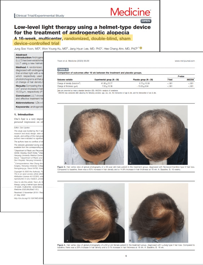 CeraDerma - 5 Published Medicine study and hair comparison images