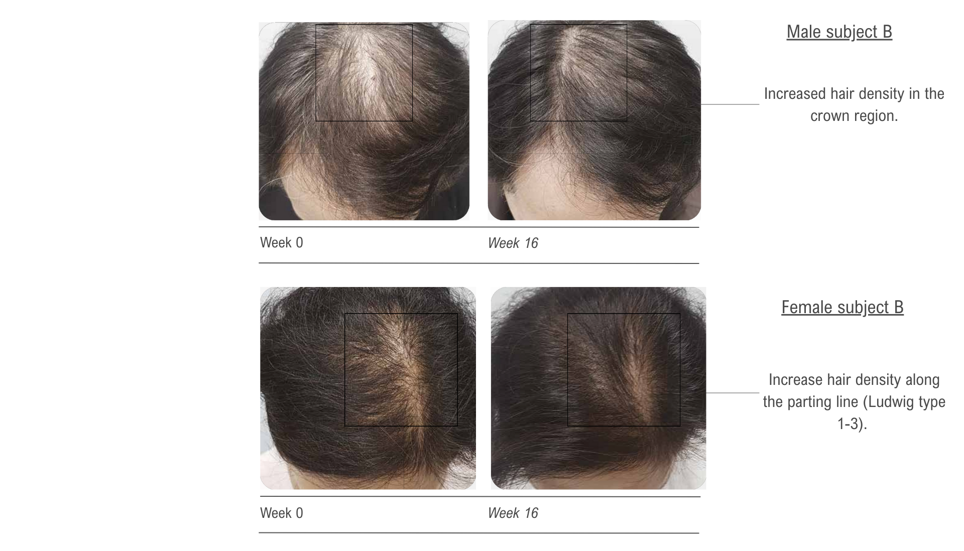 before and after 2 1