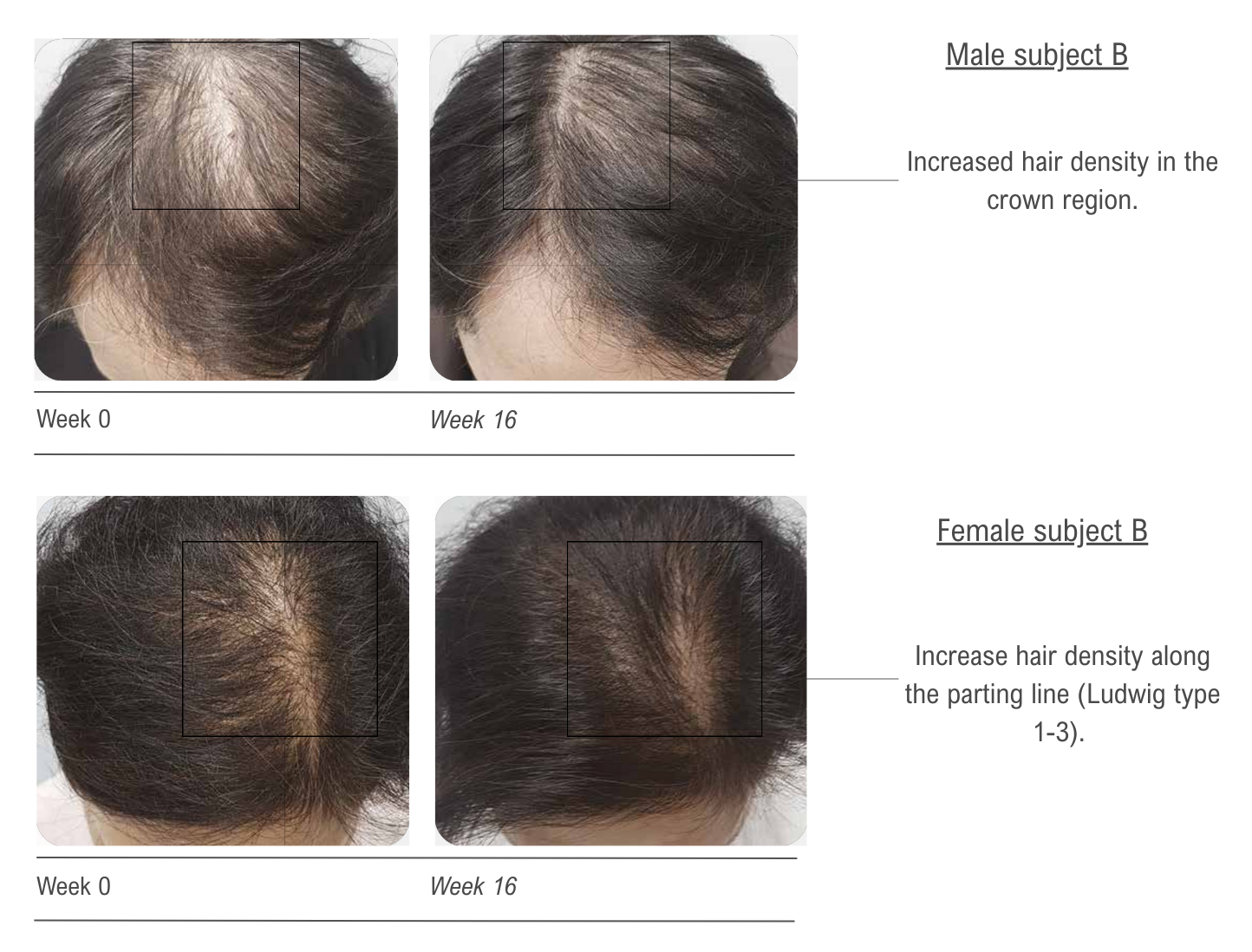 before and after 2 mobile