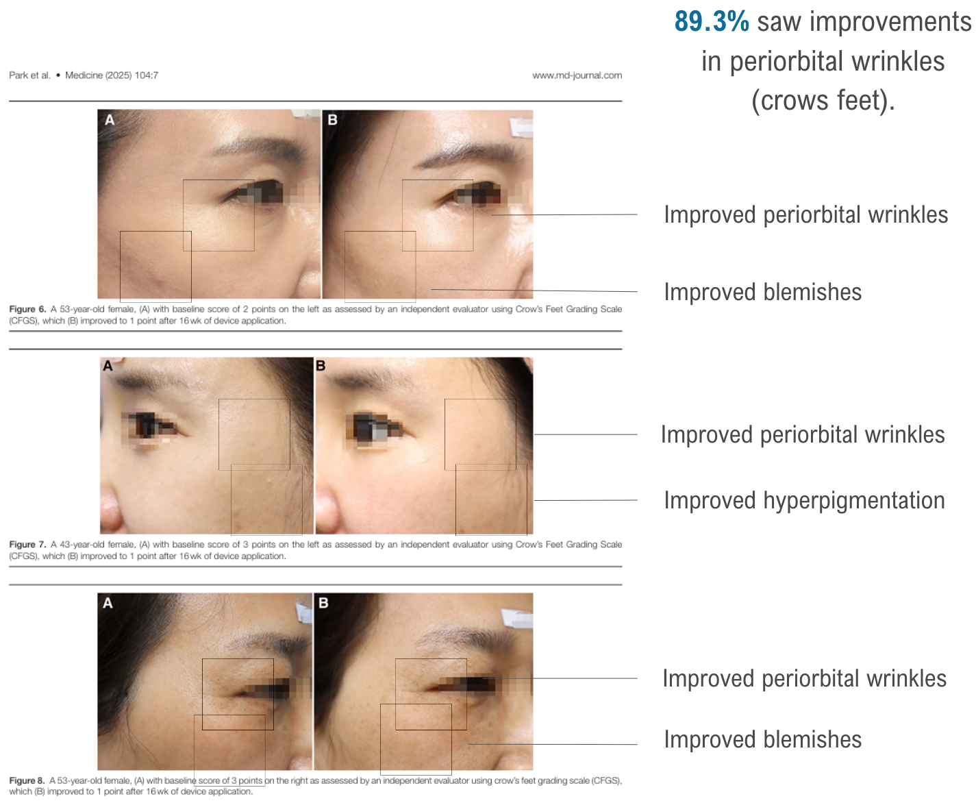 improved wrinkles.mobile.layout